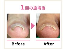 一宮巻き爪センター