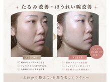 りたの雰囲気(太田で本格的エイジングケアできるフェイシャルサロン)