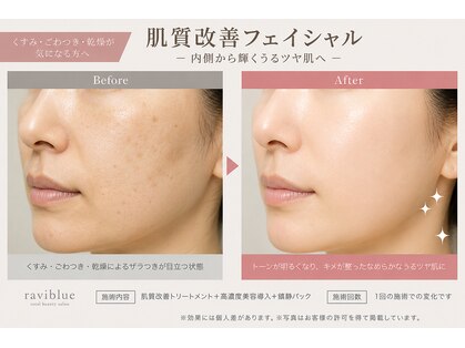 ラヴィブルー(raviblue)の写真