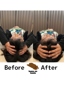 クマの冬眠 高知店/アタマほぐし