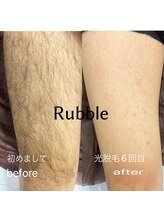 ラブル(Rubble)/beforeafter