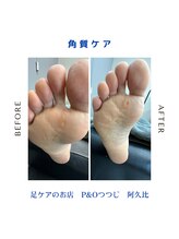 ピーアンドオー(P&O)/角質ケア