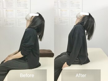 ナオル整体 国分寺院(NAORU整体)/30代女性【産後の疲れ】