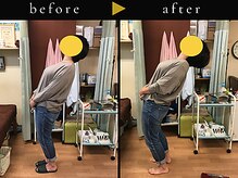 杉本接骨鍼灸院/背骨から全身がユルユル整体