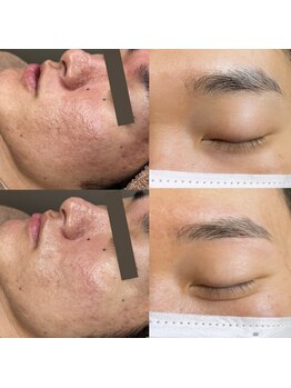 お肌をきれいにしたい