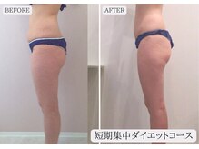 ルミア 函館店(LuMia)/激痩せ短期集中ダイエットコース