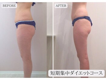 ルミア 函館店(LuMia)/激痩せ短期集中ダイエットコース