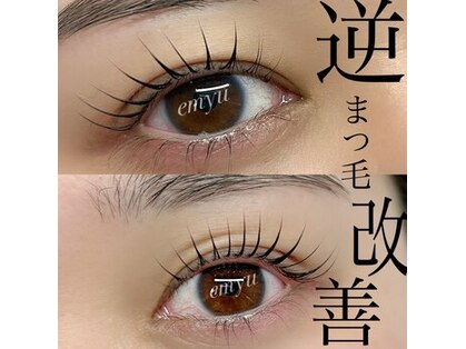 エミュー(emyu)の写真