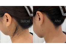 アウラ 表参道(AURA)/うなじ