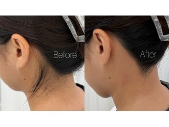 アウラ 表参道(AURA)/うなじ