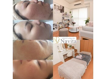 ナヴィータ アオバダイ(Navita AOBADAI)