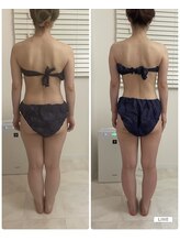 メロウプラス 錦糸町店/「バックライン」オーダーメイド