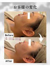 エムボーテ 太田店(M BEAUTE33)/顔筋小顔コルギ