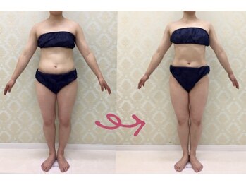 チャーム(Charm)/