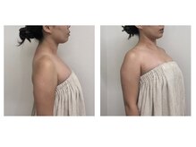 ジェム鍼灸サロン 横浜元町(gem鍼灸サロン)/姿勢が良いことのメリット