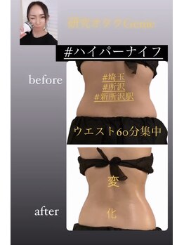 ジーニー(Genie)/ハイパーナイフ＆肋骨締め