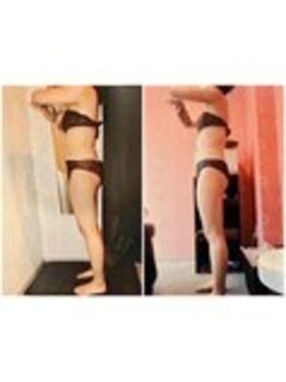 クイーン 天王寺店(Queen)/お客様 ビフォーアフター(1)