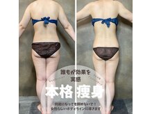 チッチ(CHiCCHi)の雰囲気（【痩身】キレイに痩せたい方！むくみが取れない方へもオススメ♪）