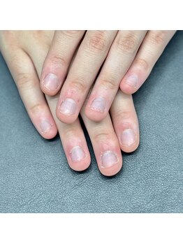 ヒューマン鍼灸接骨院/深爪の原因と予防方法