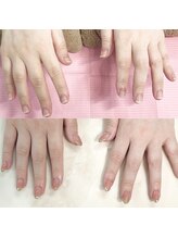 ハッカネイル(HAKKA NAIL)/