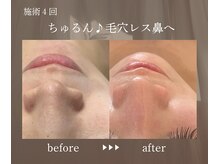 エメ(eme)/乾燥毛穴落としすぎない毛穴ケア