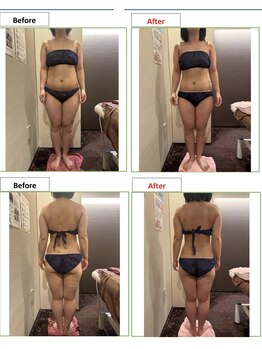 エステティック レイビス 銀座店(RAYVIS)/