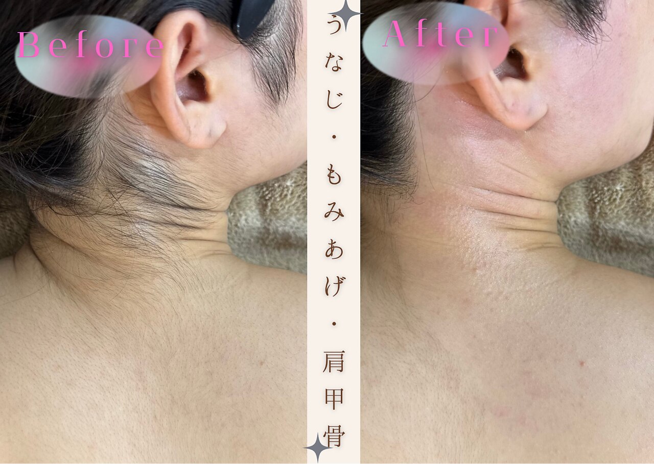 C055387319.jpg?impolicy=