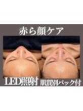 マヴィ 香里園店(MavY.)/LEDでお悩み解消