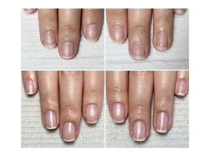 ミュウネイル 宜野湾(Myu nail)の写真