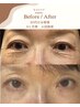 【NOBIRU】年齢によるお悩みに、月１回のサロンケア　(まぶた)　￥3000