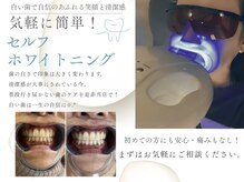 レイズ(RAISE)の雰囲気（初心者にも安心♪セルフホワイトニングで美歯活!!）
