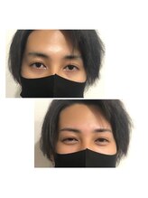 リンク(LINK)/眉毛症例