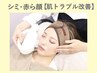 【光フォト】透明感アップ＆お肌トラブル改善★ラジオ波&パック付￥8000