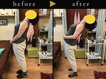 杉本接骨鍼灸院/背骨から全身がユルユル整体