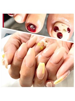 ルーネイル(Ruunail)/