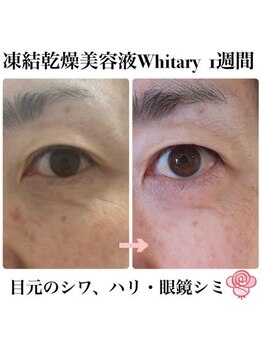 ケンビラク(Kenbiraku 健美楽)/目元のシワ・ハリ・眼鏡シミ　