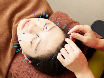 塚口駅前はら鍼灸整骨院の写真/【美容鍼で憧れの小顔に】二重あごやフェイスラインのもたつきが気になる方必見◎むくみもスッキリ解消♪