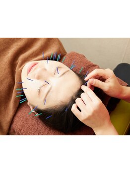 鍼灸施術を受けたい