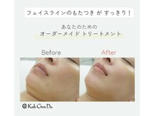 江原道 銀座サロン(Koh Gen Do)の雰囲気（KohGenDoならではの“本物の素肌美”を、銀座サロンで。）