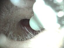 イヤースコープサロン叶 新宿店/施術後