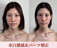 エレミュー(Elemue)