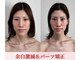 エレミュー(Elemue)の写真