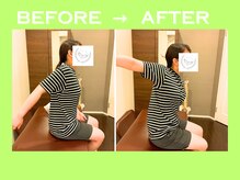 こころ整骨院/30代女性のビフォーアフター