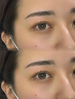 ジュノン 四ツ谷店(junon)の写真/コスメリフトで理想の可愛さ◎全てに美容成分配合！眉スタイリング同日施術でモテ可愛な目元へ☆