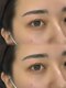 ジュノン 四ツ谷店(junon)の写真/コスメリフトで理想の可愛さ◎全てに美容成分配合！眉スタイリング同日施術でモテ可愛な目元へ☆