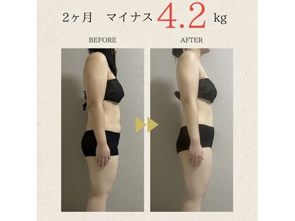 オパージュ(Opage)の写真