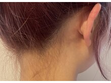 フォクシーワックス 立川店(FOXY WAX)/【ビフォー】うなじ