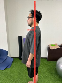 サンライズスポーツアカデミー(Sunrise Sports Academy)/ストレッチ整体*After