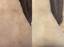 ノイエ(NOIE)の雰囲気（長年悩んだ肌悩みハーブピーリングで肌質改善！お顔もボディも◎）