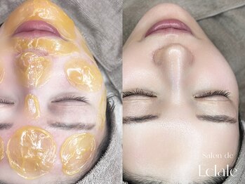 サロンドエクラル(Salon de Eclale wax)/【今話題】即水光ツヤ！艶肌wax